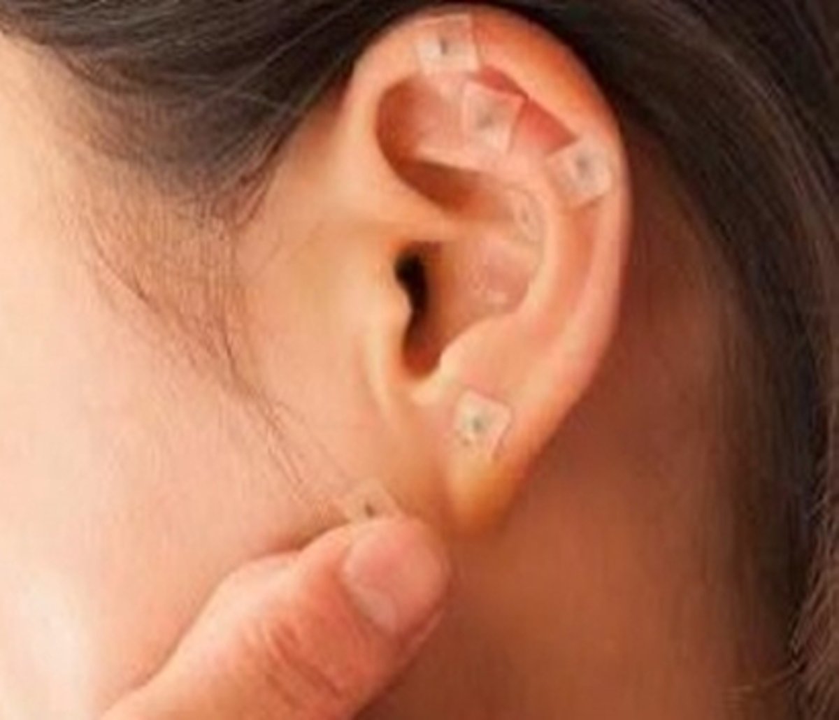 Imagem da publicação original: Auriculoterapia e seus benefícios